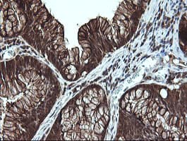 Monoclonal Mouse anti-Human LGALS3 / Galectin 3 Antibody (clone 1G8, Carrier-free, IHC, IF, WB)