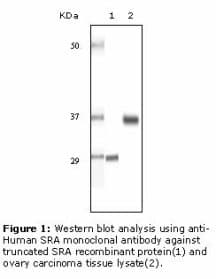Monoclonal Mouse anti-Human SRA1 / SRA Antibody (clone 7H1G1, IHC, WB)