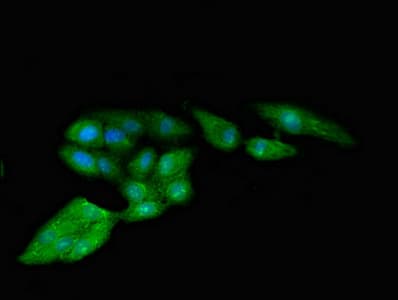 RPS4X + RPS4Y1 + RPS Antibody