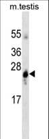 GSTA1 Antibody