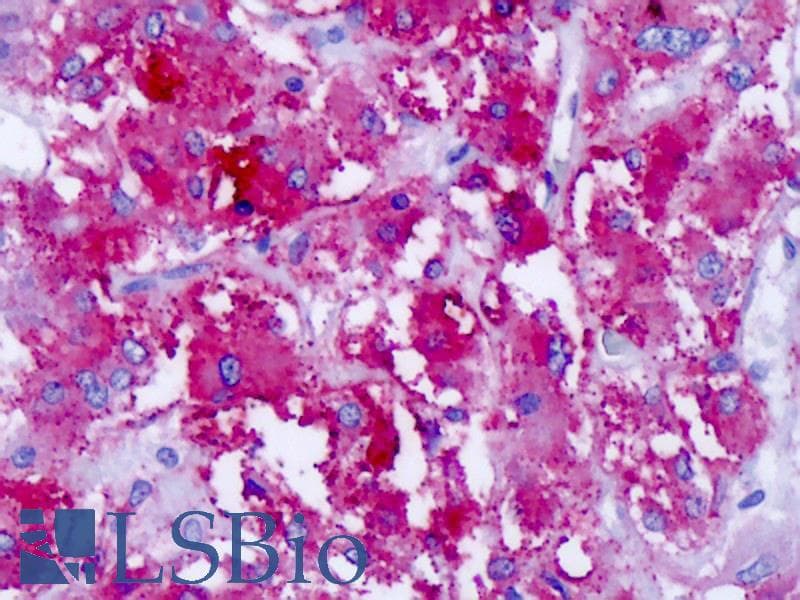IHC-plus™ CELSR1 Antibody (C-Terminus)