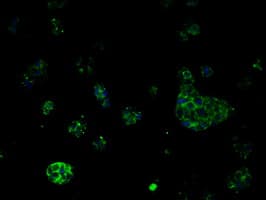 Monoclonal Mouse anti-Human MCL1 / MCL 1 Antibody (clone OTI4B7, IHC, IF, WB)