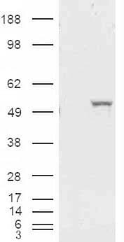 IHC-plus™ ALDH1A1 / ALDH1 Antibody (aa476-488)
