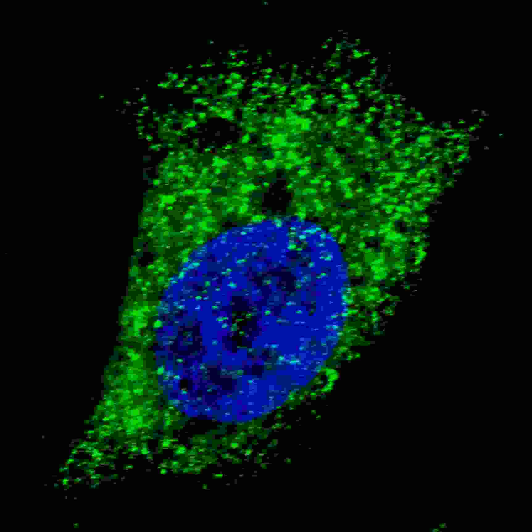 Polyclonal Rabbit anti-Human MAP1LC3A / LC3A Antibody (aa89-120, IHC, IF, WB)