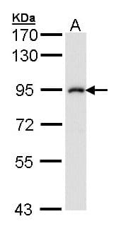 IKBKB / IKK2 / IKK Beta Antibody (aa493-739)
