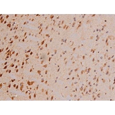 Polyclonal Rabbit anti-Human c-Kit / CD117 Antibody (IHC, IF, WB)