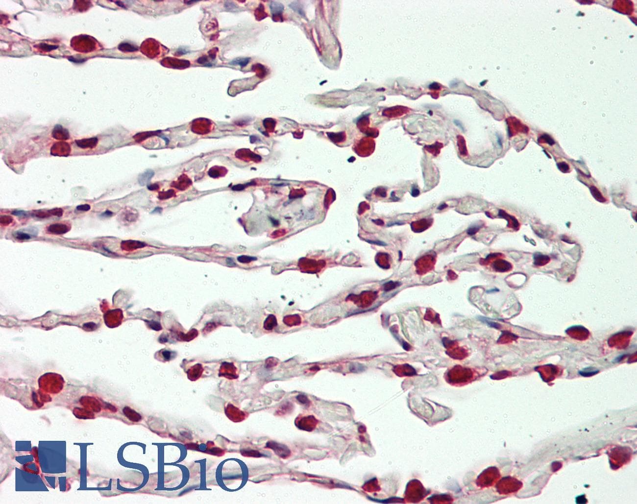 IHC-plus™ BTBD9 Antibody (aa237-262)