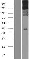 Human NHSL1 Protein (Over-Expression Lysate Myc-DDK (Flag))