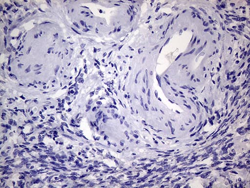 AGR2 Antibody (aa21-175, clone OTI3F2)