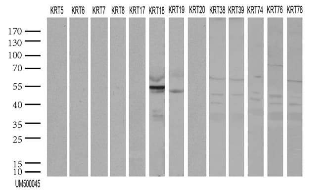 KRT18 / CK18 / Cytokeratin 18 Antibody (aa69-372, clone UMAB50)