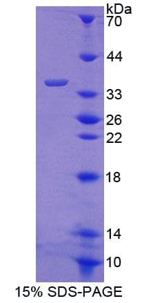 Mouse ABCB7 Protein (Recombinant His-T7, N-terminus)
