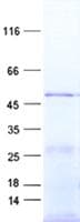 Human HPT / MRS2L Protein (Recombinant His, N-Terminal)