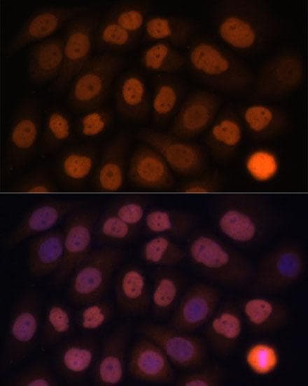 KLF6 Antibody