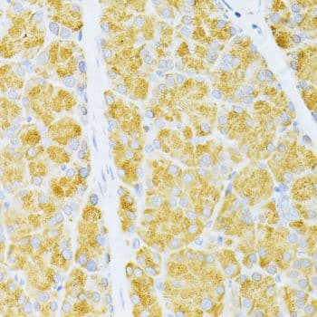 Polyclonal Rabbit anti-Human CD135 / FLT3 Antibody (IHC, WB)