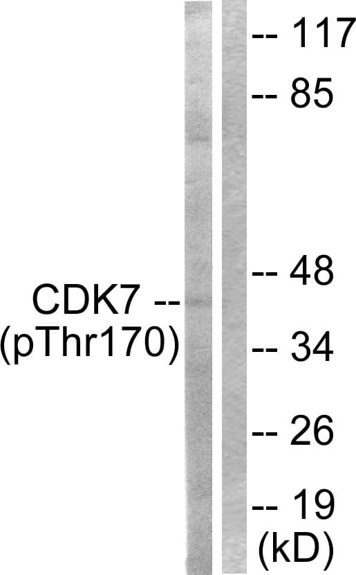 CDK7 Antibody (phospho-Thr170)