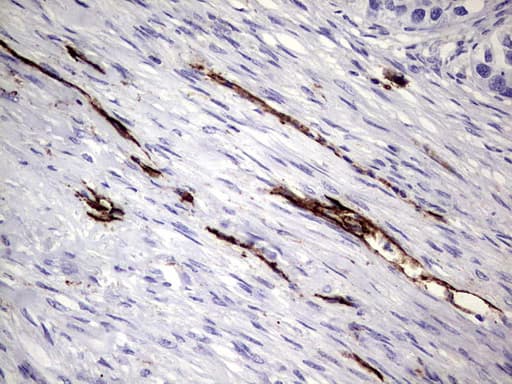 PECAM-1 / CD31 Antibody (clone UMAB164)