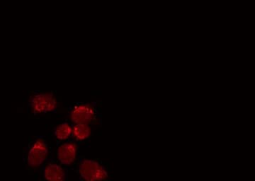 COUP-TFII / NR2F2 Antibody