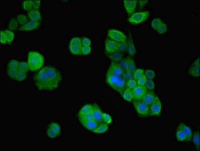 Polyclonal Rabbit anti-Human VPS26B Antibody