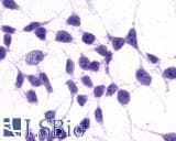 PathPlus™ GRM3 / MGLUR3 Antibody (N-Terminus)