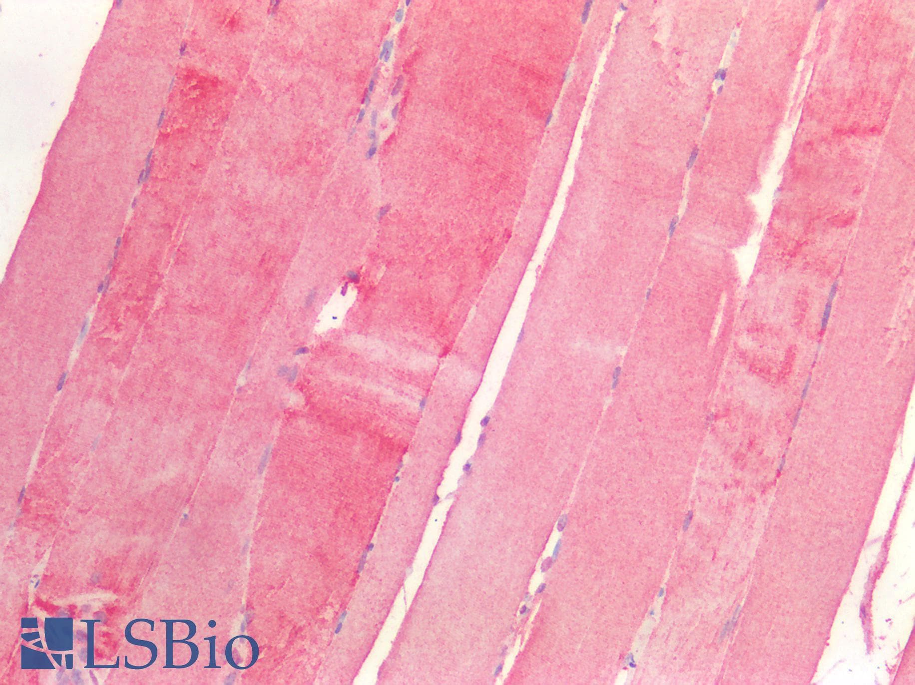 PathPlus™ P4HA1 Antibody (clone 4F1)