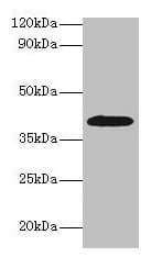 ADH2 / ADH1B Antibody