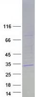 Human STAR Protein (Recombinant Myc-DDK (Flag))