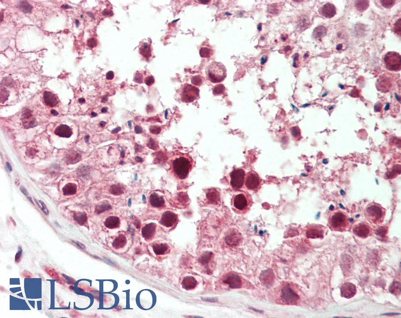 IHC-plus™ KIF2C / MCAK Antibody (aa50-100)