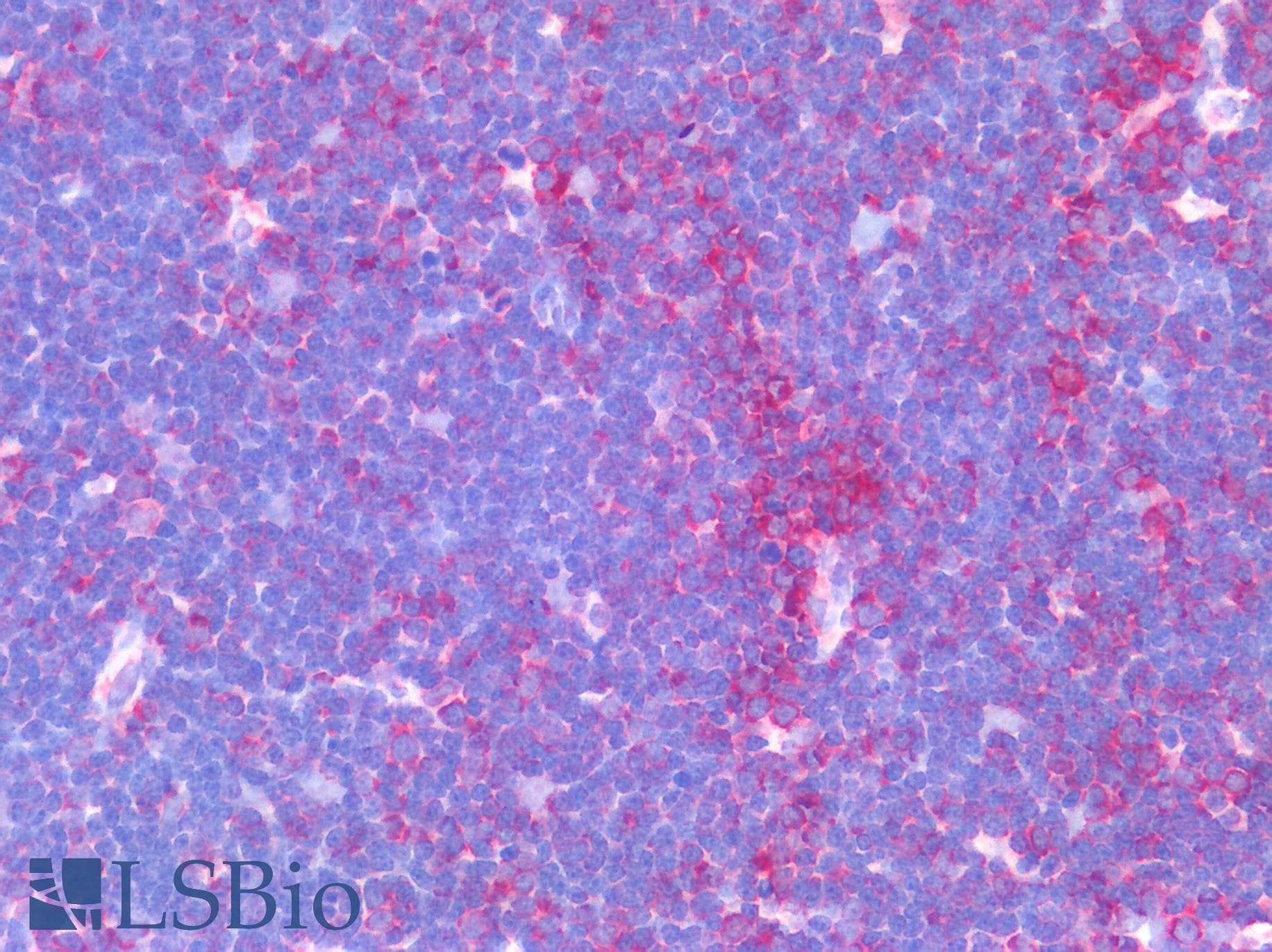 IHC-plus™ IL-1B / IL-1 Beta Antibody