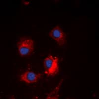 Polyclonal Rabbit anti-Human MtTFA / TFAM Antibody (Internal, IHC, IF, WB)
