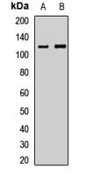 Polyclonal Rabbit anti-Human LLGL2 Antibody (IHC, WB)