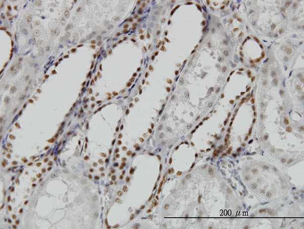 Monoclonal Mouse anti-Human DCPS Antibody (clone 1G4, IHC, IF, WB)