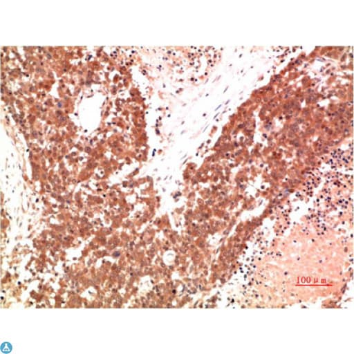 Monoclonal Mouse anti-Human PRKAA1 / AMPK Alpha 1 Antibody (IHC, WB)