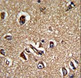 STRAP / MAWD Antibody (aa242-269)