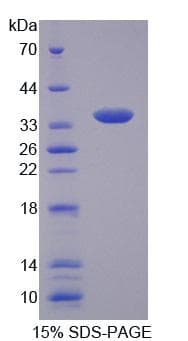 Human SLC25A1 / SEA Protein (Recombinant His, N-Terminal)
