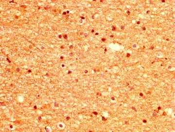 MSI1 / Musashi 1 Antibody
