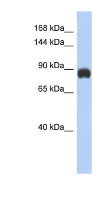 Polyclonal Rabbit anti-Human GRM6 / MGLUR6 Antibody (aa359-408, WB)