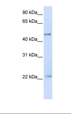TRIM21 / RO52 Antibody (aa144-193)
