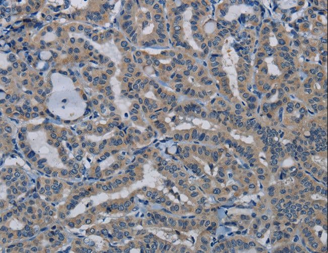 PIK3CB / PI3K Beta Antibody