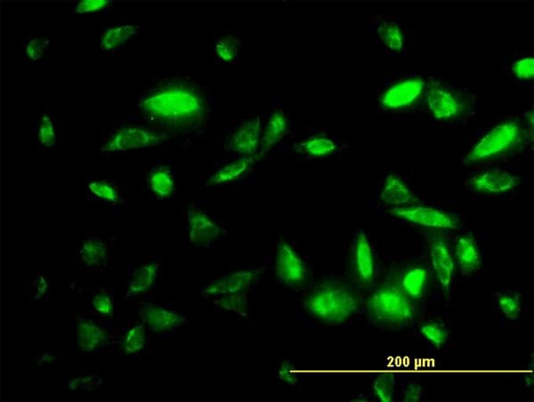 PEPD / PROLIDASE Antibody (clone 1D5-H3)