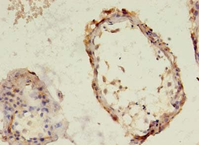 TBC1D20 Antibody