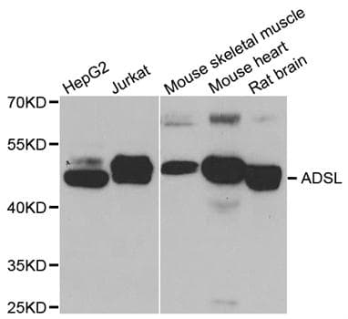 ADSL / Adenylosuccinate Lyase Antibody