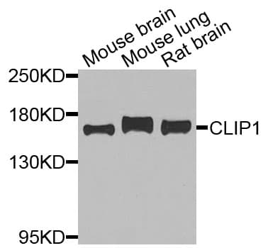 Polyclonal Rabbit anti-Human CLIP1 / CLIP-170 Antibody (IHC, WB)