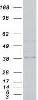 Human MSX1 Protein (Recombinant Myc-DDK (Flag))