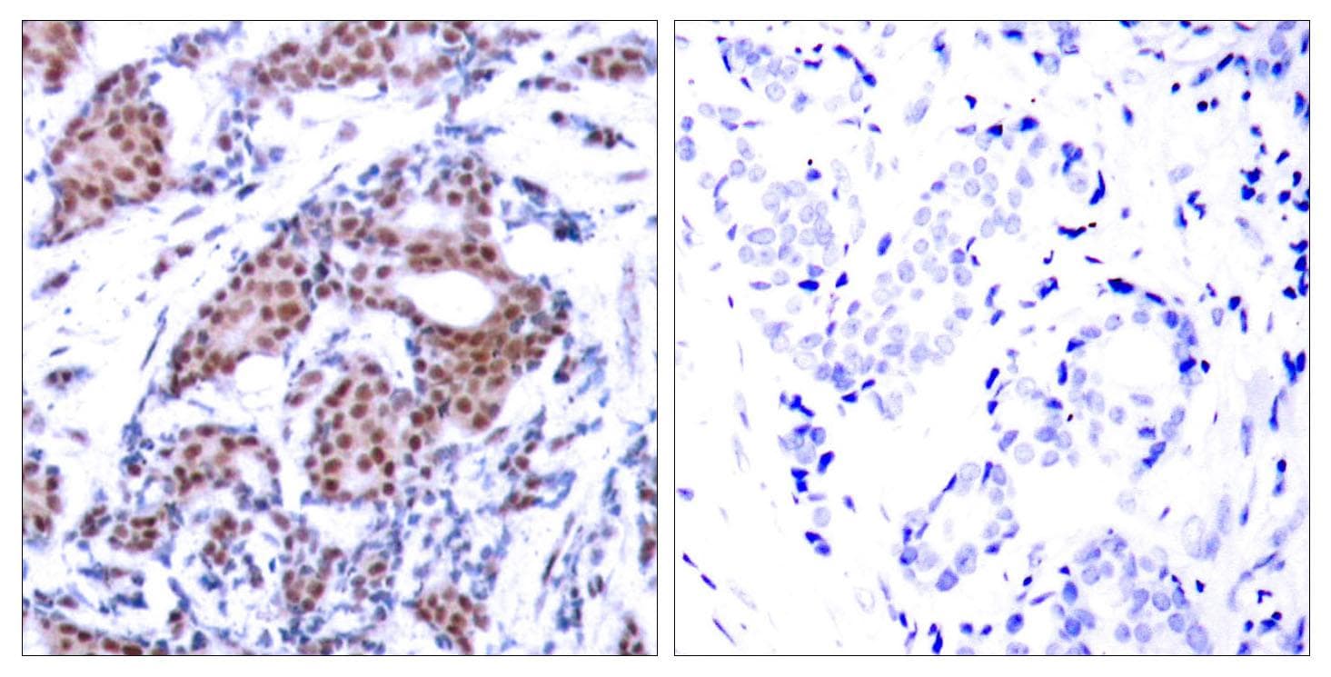 ELK1 Antibody (phospho-Ser383)