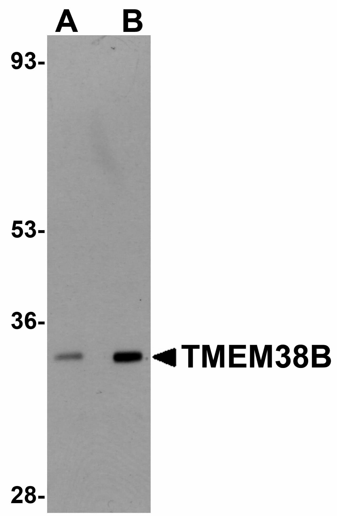 IHC-plus™ Polyclonal Rabbit anti-Human TMEM38B Antibody (IHC, IF, WB)