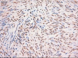 MYC / c-Myc Antibody (clone OTI5G3)