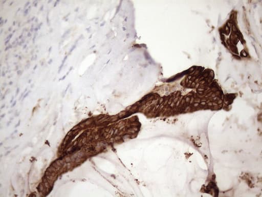 KRT18 / CK18 / Cytokeratin 18 Antibody (aa69-372, clone OTI3D1)