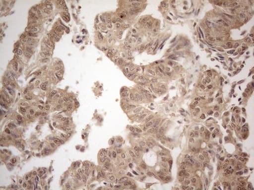Monoclonal Mouse anti-Human PPP1CA / PP1-Alpha Antibody (clone OTI6E5, IHC, WB)