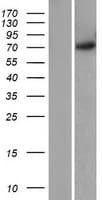 Human GRK5 Protein (Over-Expression Lysate Myc-DDK (Flag))