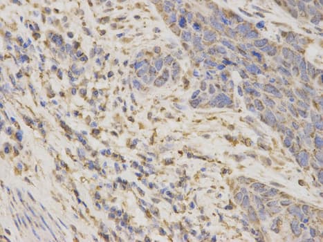IHC-plus™ ARSA / Arylsulfatase A Antibody